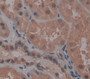 Mdm2 P53 Binding Protein Homolog (Mdm2) Polyclonal Antibody, Cat#CAU22159