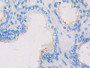 DAB staining on IHC-P; Samples: Human Prostate Gland Tissue