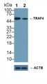 Knockout Varification: ; Lane 1: Wild-type Jurkat cell lysate; ; Lane 2: TRAF4 knockout Jurkat cell lysate; ; Predicted MW: 54,23kd ; Observed MW: 54kd; Primary Ab: 1µg/ml Rabbit Anti-Human TRAF4 Antibody; Second Ab: 0.2µg/mL HRP-Linked Caprine Anti-Rabbit IgG Polyclonal Antibody;