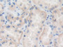 DAB staining on IHC-P; Samples: Human Kidney Tissue