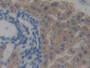 DAB staining on fromalin fixed paraffin- embedded Kidney tissue)