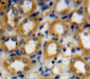 DAB staining on fromalin fixed paraffin-embedded kidney tissue)