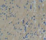 Tropomodulin 1 (Tmod1) Polyclonal Antibody, Cat#CAU22173