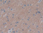 DAB staining on IHC-P; Samples: Human Brain Tissue