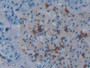 DAB staining on fromalin fixed paraffin- embedded testis tissue)