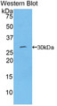 Western Blot; Sample: Recombinant protein.