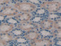 DAB staining on IHC-P; Samples: Human Kidney Tissue;  Primary Ab: 20µg/ml Rabbit Anti-Human TOR3A An