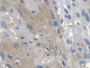 DAB staining on IHC-P; Samples: Human Esophagus Tissue; Primary Ab: 20µg/ml Rabbit Anti-Human ARSA Antibody Second Ab: 2µg/mL HRP-Linked Caprine Anti-Rabbit IgG Polyclonal Antibody