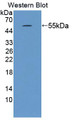 Western Blot; Sample: Recombinant protein.