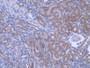 DAB staining on IHC-P; Samples: Mouse Kidney Tissue;  Primary Ab: 20µg/ml Rabbit Anti-Mouse PEBP1 An