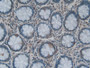DAB staining on IHC-P; Samples: Human Rectum Tissue; Primary Ab: 20µg/ml Rabbit Anti-Human LPCAT3 Antibody Second Ab: 2µg/mL HRP-Linked Caprine Anti-Rabbit IgG Polyclonal Antibody