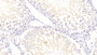 DAB staining on IHC-P; Samples: Rat Testis Tissue; Primary Ab: 20μg/ml Rabbit Anti-Rat DSTYK Antibody Second Ab: 2µg/mL HRP-Linked Caprine Anti-Rabbit IgG Polyclonal Antibody