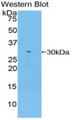 Western Blot; Sample: Recombinant protein.