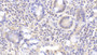 DAB staining on IHC-P; Samples: Human Small intestine Tissue; Primary Ab: 20μg/ml Rabbit Anti-Human ROR1 Antibody Second Ab: 2µg/mL HRP-Linked Caprine Anti-Rabbit IgG Polyclonal Antibody