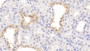 DAB staining on IHC-P; Samples: Human Kidney Tissue;  Primary Ab: 20μg/ml Rabbit Anti-Human STAR Antibody Second Ab: 2µg/mL HRP-Linked Caprine Anti-Rabbit IgG Polyclonal Antibody 