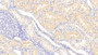 DAB staining on IHC-P; Samples: Human Kidney Tissue;  Primary Ab: 20μg/ml Rabbit Anti-Human LCN12 Antibody Second Ab: 2µg/mL HRP-Linked Caprine Anti-Rabbit IgG Polyclonal Antibody 