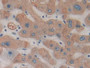 DAB staining on IHC-P; Samples: Human Liver Tissue