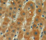 DAB staining on fromalin fixed paraffin-embedded liver tissue)