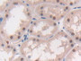 DAB staining on IHC-P; Samples: Human Kidney Tissue; Primary Ab: 30µg/ml Rabbit Anti-Human MAT2a Antibody Second Ab: 2µg/mL HRP-Linked Caprine Anti-Rabbit IgG Polyclonal Antibody