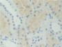 DAB staining on IHC-P; Samples: Human Kidney Tissue; Primary Ab: 10µg/ml Rabbit Anti-Human AHCY Antibody Second Ab: 2µg/mL HRP-Linked Caprine Anti-Rabbit IgG Polyclonal Antibody