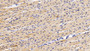 DAB staining on IHC-P; Samples: Human Cardiac Muscle Tissue;  Primary Ab: 20μg/ml Rabbit Anti-Human MTR Antibody Second Ab: 2µg/mL HRP-Linked Caprine Anti-Rabbit IgG Polyclonal Antibody 