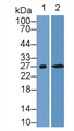 Western Blot; Sample: Lane1: Rat Kidney lysate; Lane2: Rat Cerebrum lysate; Primary Ab: 2µg/mL Rabbit Anti-Rat CALB Antibody; Second Ab: 0.2µg/mL HRP-Linked Caprine Anti-Rabbit IgG Polyclonal Antibody;