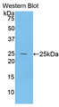 Western Blot; Sample: Recombinant protein.