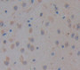 Used in DAB staining on fromalin fixed paraffin-embedded kidney tissue