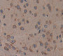 Used in DAB staining on fromalin fixed paraffin- embedded Kidney tissue