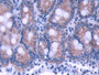 DAB staining on IHC-P; Samples: Rat Small intestine Tissue; Primary Ab: 20µg/ml Rabbit Anti-Rat ATP5b Antibody Second Ab: 2µg/mL HRP-Linked Caprine Anti-Rabbit IgG Polyclonal Antibody