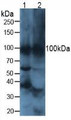 Western Blot; Sample. Lane1: Mouse Heart Tissue; Lane2: Mouse Brain Tissue.