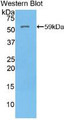 Western Blot; Sample: Recombinant protein.