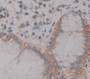 Atpase, H+/K+ Exchanging Alpha Polypeptide (Atp4A) Polyclonal Antibody, Cat#CAU22267