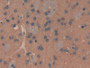 DAB staining on fromalin fixed paraffin- embedded brain tissue)