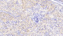 DAB staining on IHC-P; Samples: Human Kidney Tissue; Primary Ab: 20μg/ml Rabbit Anti-Human SELENBP1 Antibody Second Ab: 2µg/mL HRP-Linked Caprine Anti-Rabbit IgG Polyclonal Antibody