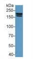 Western Blot; Sample: Rat Serum; ; Primary Ab: 1µg/ml Rabbit Anti-Rat PZP Antibody; Second Ab: 0.2µg/mL HRP-Linked Caprine Anti-Rabbit IgG Polyclonal Antibody;