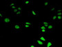 FITC staining on IHC-P; Samples: Human Hela Cells