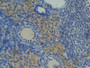 DAB staining on fromalin fixed paraffin-embedded Heart tissue)