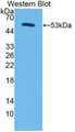 Western Blot; Sample: Recombinant protein.