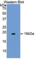 Western Blot; Sample: Recombinant protein.