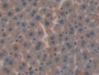 DAB staining on IHC-P; Samples: Mouse Liver Tissue; Primary Ab: 10µg/ml Rabbit Anti-Mouse CYR61 Antibody Second Ab: 2µg/mL HRP-Linked Caprine Anti-Rabbit IgG Polyclonal Antibody