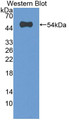 Western Blot; Sample: Recombinant protein.