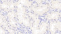 DAB staining on IHC-P; Samples: Human Kidney Tissue;  Primary Ab: 20μg/ml Rabbit Anti-Human CBLN1 Antibody Second Ab: 2µg/mL HRP-Linked Caprine Anti-Rabbit IgG Polyclonal Antibody 