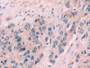 DAB staining on fromalin fixed paraffin-embedded liver tissue)