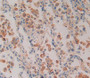 Used in DAB staining on fromalin fixed paraffin- embedded Kidney tissue