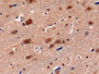 DAB staining on IHC-P; Samples: Human Cerebrum Tissue;  Primary Ab: 10µg/ml Rabbit Anti-Human PSMC3 