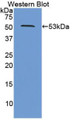 Western Blot; Sample: Recombinant protein.