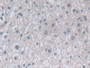 DAB staining on IHC-P; Samples: Human Liver Tissue; Primary Ab: 30µg/ml Rabbit Anti-Human PSMb6 Antibody Second Ab: 2µg/mL HRP-Linked Caprine Anti-Rabbit IgG Polyclonal Antibody