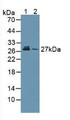 Western Blot; Sample: Lane1: Human Lung Tissue; Lane2: Human Hela Cells.