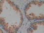 DAB staining on IHC-P; Samples: Human Prostate Gland Tissue.
